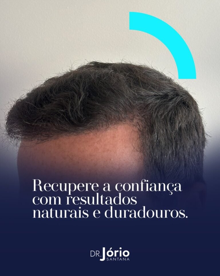 Instagram post from drjoriosantana. This post is in position 1.